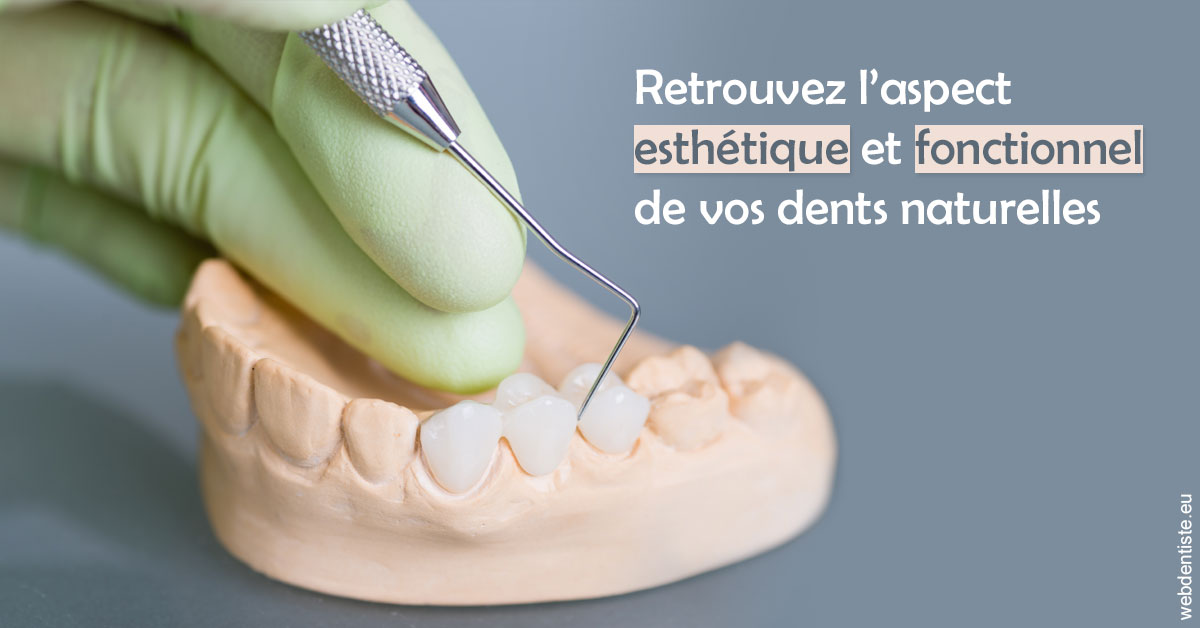 https://dr-sebastien-ginfray.chirurgiens-dentistes.fr/Restaurations dentaires 1