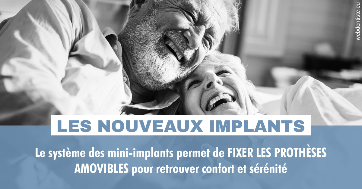 https://dr-sebastien-ginfray.chirurgiens-dentistes.fr/Les nouveaux implants 2