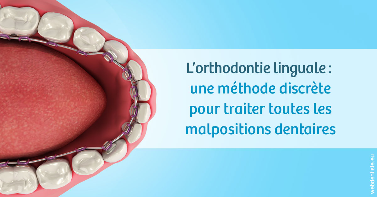 https://dr-sebastien-ginfray.chirurgiens-dentistes.fr/L'orthodontie linguale 1
