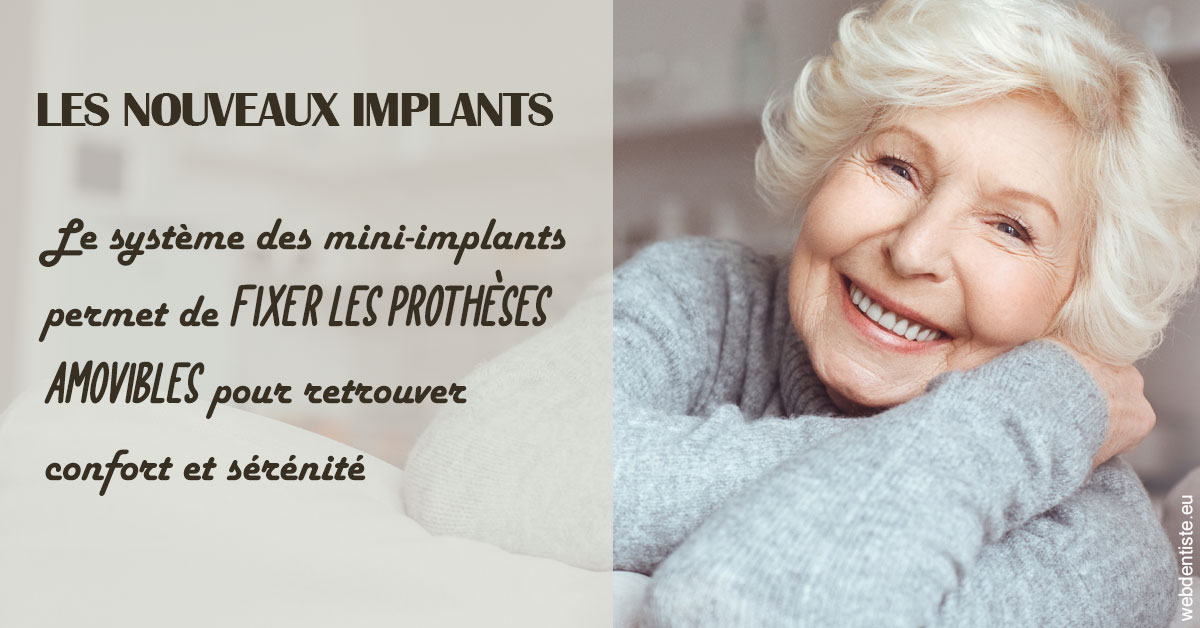 https://dr-sebastien-ginfray.chirurgiens-dentistes.fr/Les nouveaux implants 1