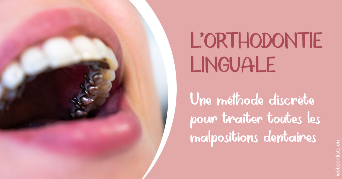 https://dr-sebastien-ginfray.chirurgiens-dentistes.fr/L'orthodontie linguale 2