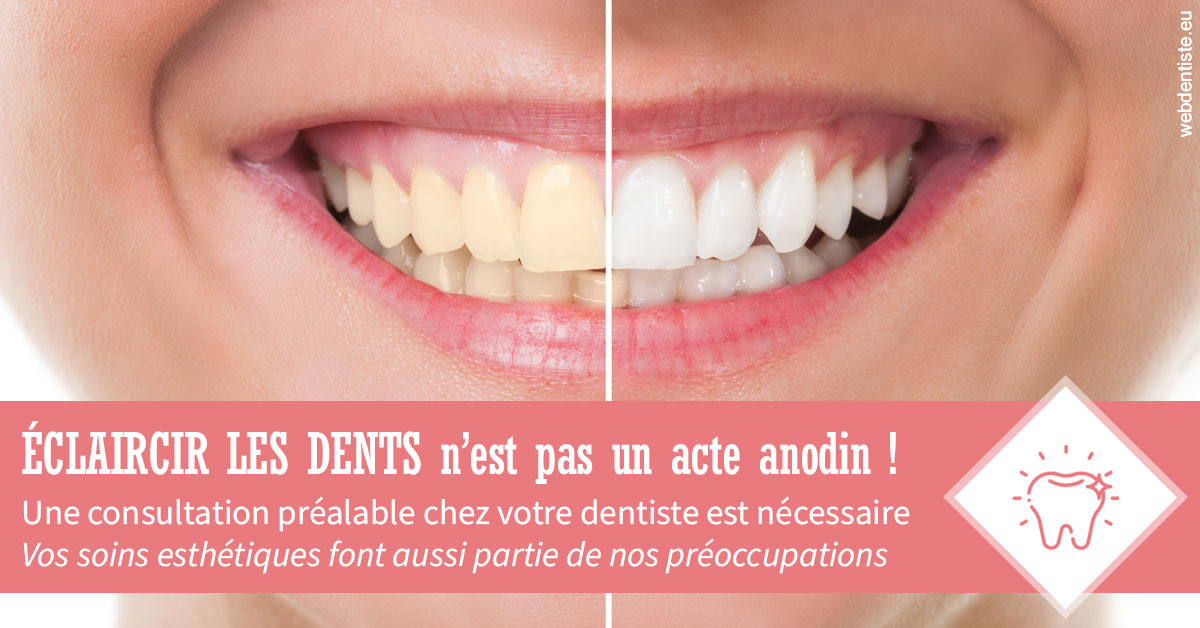 https://dr-sebastien-ginfray.chirurgiens-dentistes.fr/Eclaircir les dents 1