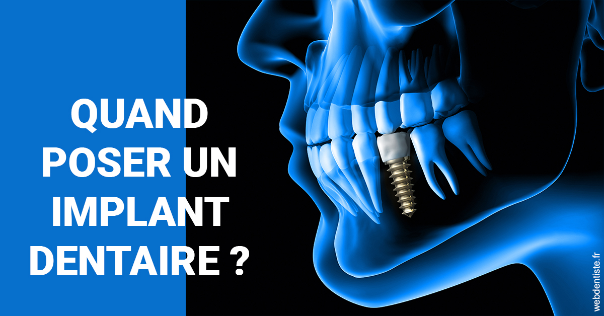 https://dr-sebastien-ginfray.chirurgiens-dentistes.fr/Les implants 1