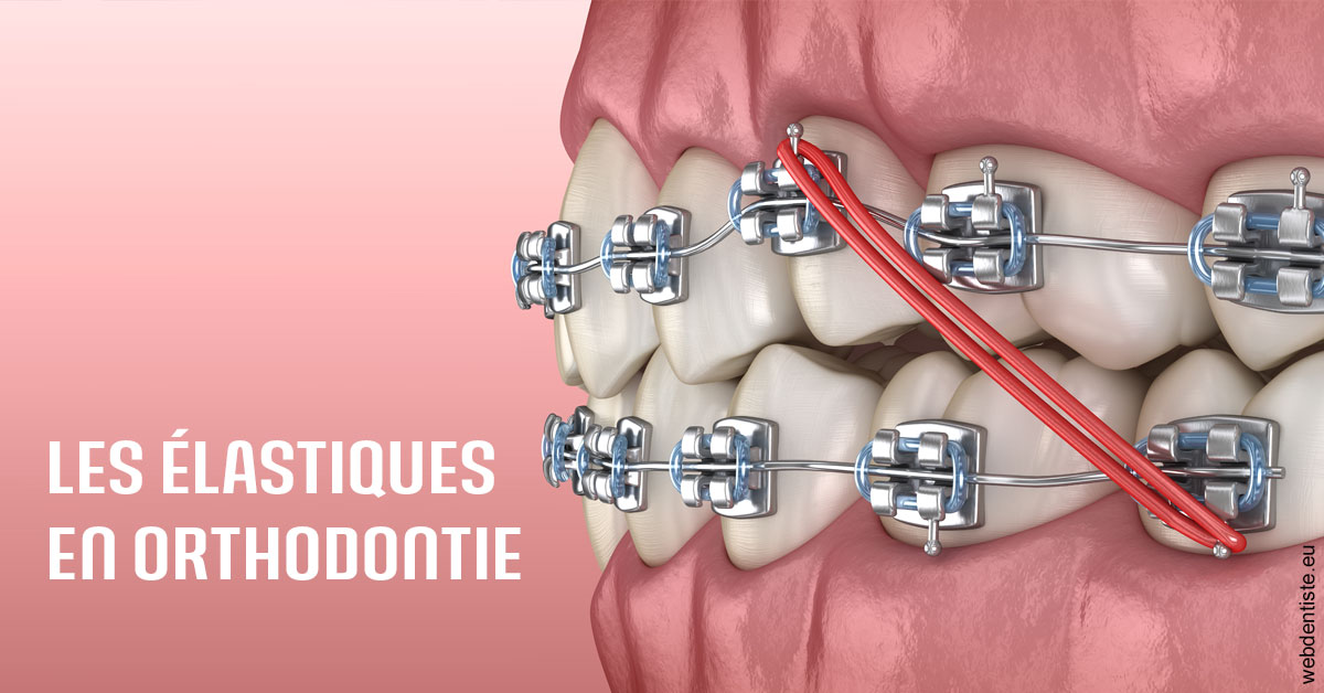 https://dr-sebastien-ginfray.chirurgiens-dentistes.fr/Elastiques orthodontie 2