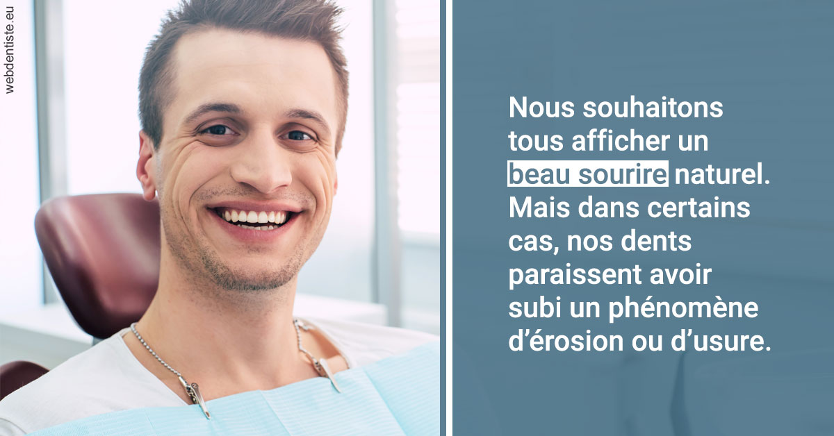 https://dr-sebastien-ginfray.chirurgiens-dentistes.fr/Érosion et usure dentaire